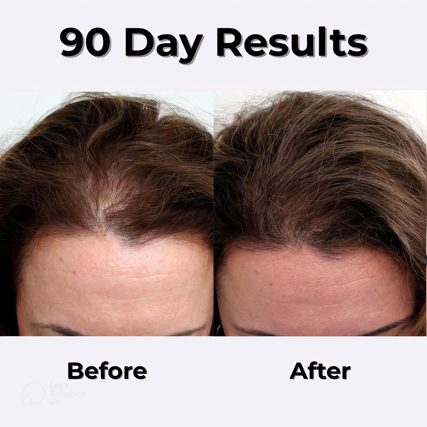 ReviBrush™ - Scalp Rejuvenation Therapy Brush